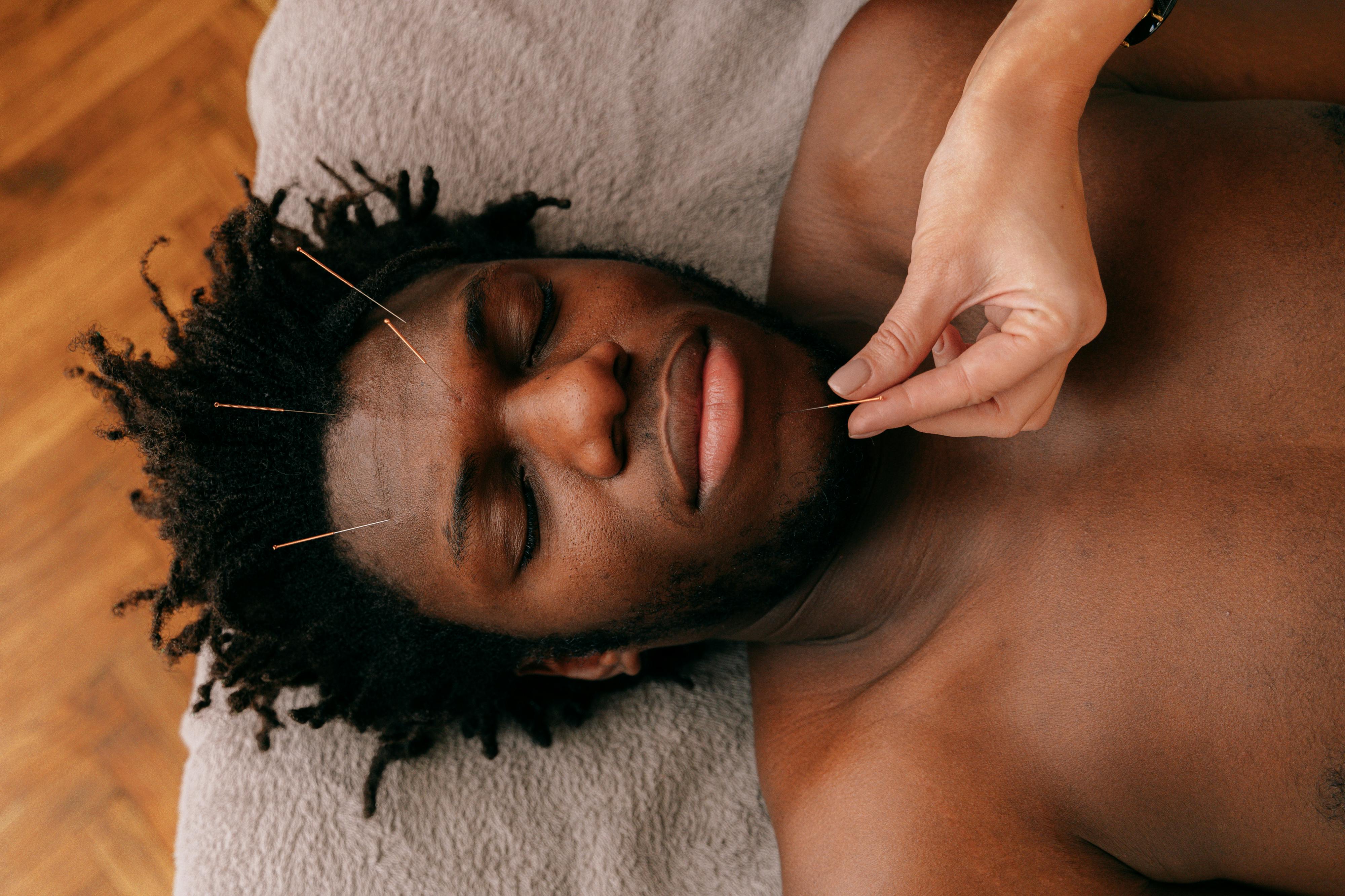 Acupuncture and Traditional Chinese Medicine session